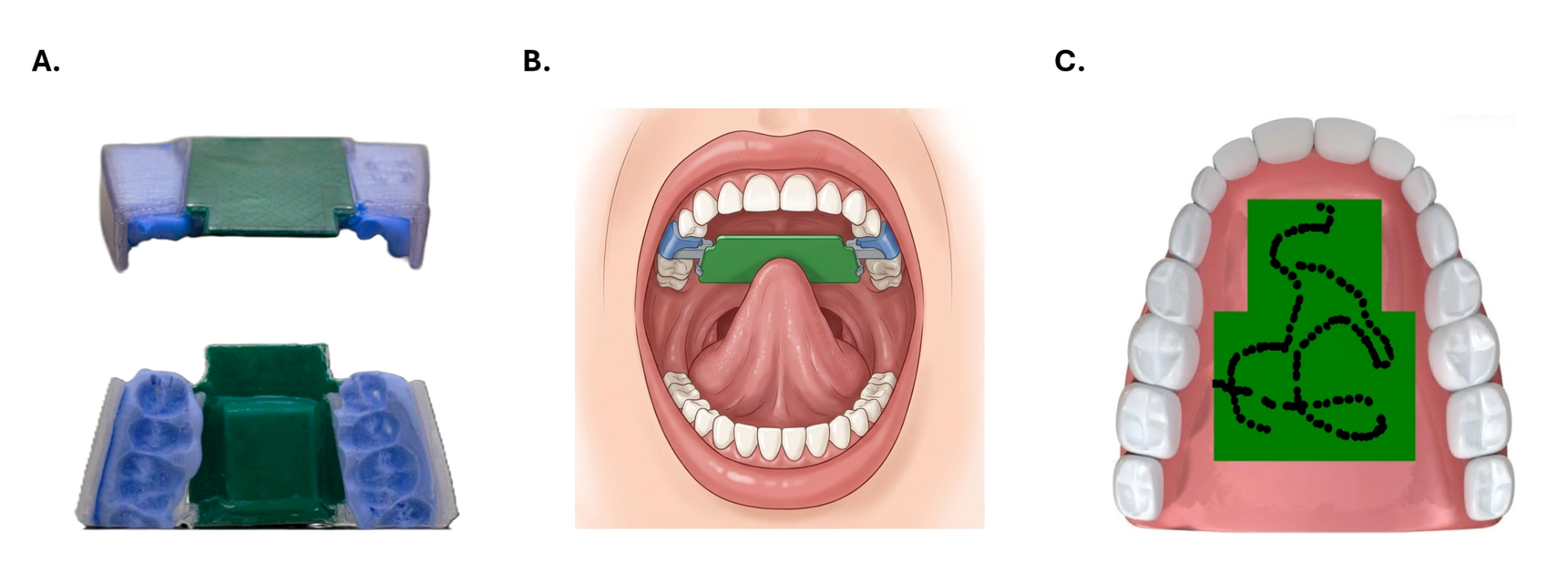 Tongue-Trackpad retaining system, intra-oral placement, and tongue movement visualization